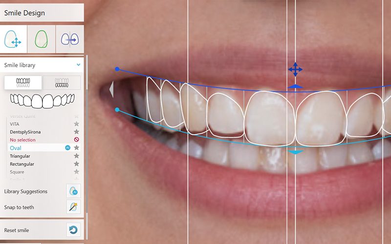 TRIOS Smile Design 22